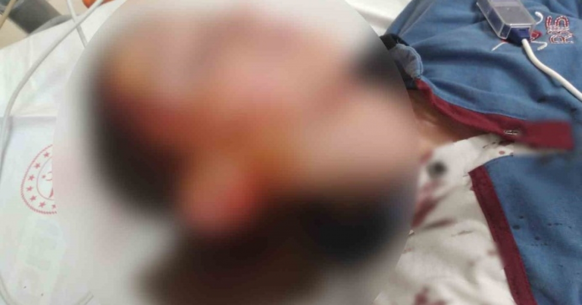 KÖPEK SALDIRISINDA YARALANAN ÇOCUK İÇİN 1 MİLYON 200 BİN TAZMİNAT