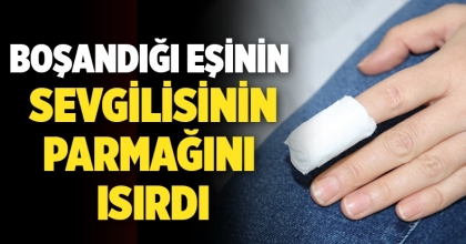 Boşandığı Eşinin Sevgilisinin Parmağını Isırdı