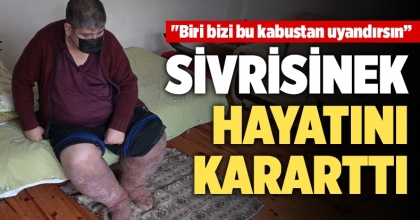 Sivrisinek hayatını kararttı