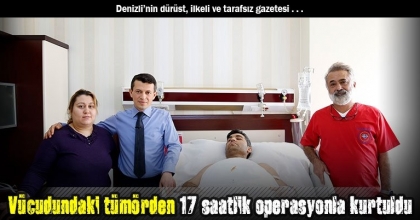  Vücudundaki tümörden 17 saatlik operasyonla kurtuldu
