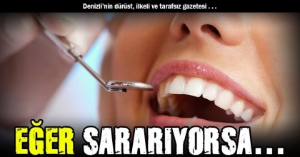 EĞER SARARIYORSA…