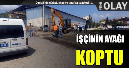 İŞÇİNİN AYAĞI KOPTU 