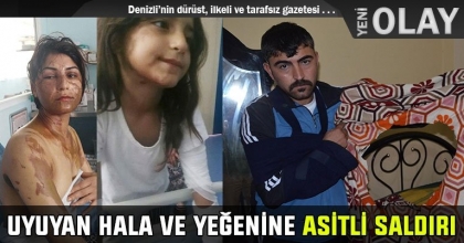 UYUYAN HALA VE YEĞENİNE ASİTLİ SALDIRI