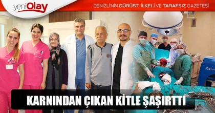 KARNINDAN ÇIKAN KİTLE ŞAŞIRTTI