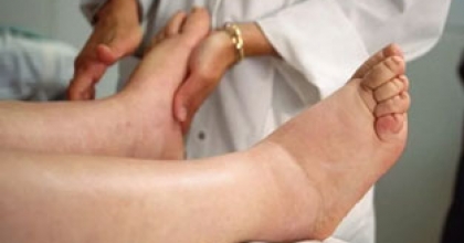 “LENFÖDEM HAYAT BOYU TEDAVİ GEREKTİREBİLİR”