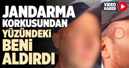 JANDARMA KORKUSUNDAN YÜZÜNDEKİ BENİ ALDIRDI