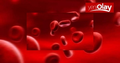 Akdeniz Anemisi (Talasemi) Belirtileri ve Tedavi Yöntemleri