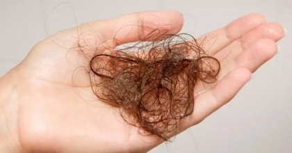 Rüyada Kıl Görmek Anlamı