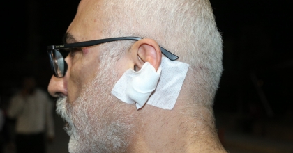 GAZETECİYE TEKME, YUMRUK VE BIÇAKLI SALDIRI