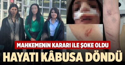 EŞİNDEN ŞİDDET GÖREN KADININ HAYATI KÂBUSA DÖNDÜ