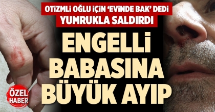 ENGELLİ BABASINA BÜYÜK AYIP