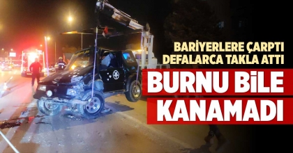 BURNU BİLE KANAMADAN ÇIKTI