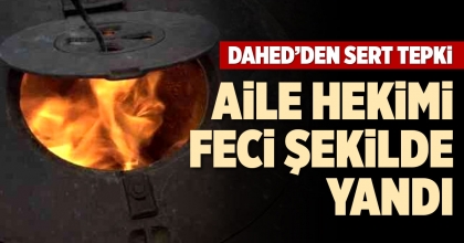 AİLE HEKİMİ FECİ ŞEKİLDE YANDI