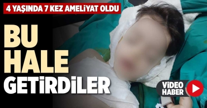 BU HALE GETİRDİLER