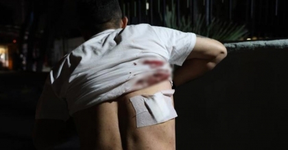 TAKSİCİDEN “ARACIMI KAPATTIM” CEVABINI ALAN YOLCU, ŞOFÖRÜN SIRTINA MAKAS SAPLADI