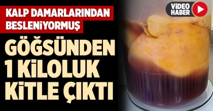 GÖĞSÜNDEN 1 KİLOLUK KİTLE ÇIKTI