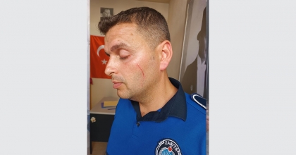 PİŞKİN DİLENCİ ZABITAYI YARALADI