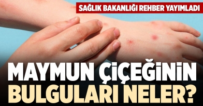 MAYMUN ÇİÇEĞİNİN BULGULARI NELER?