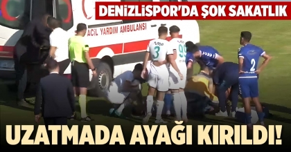 UZATMADA AYAĞI KIRILDI!