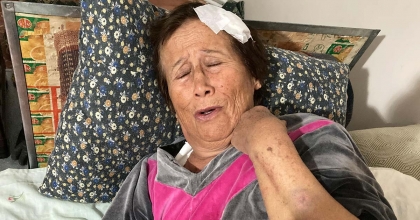 66 YAŞINDAKİ KADINI SOPA VE BİSİKLET İLE ACIMASIZCA DARP ETTİ