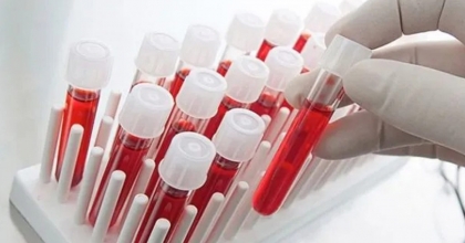 KAN GRUBU A RH+ OLANLAR DİKKAT! 