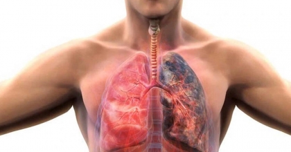 KOAH HASTALARINA ÖNEMLİ UYARI