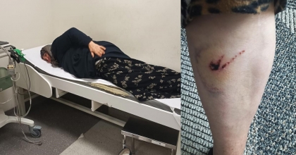 SOKAK KÖPEKLERİNİN SALDIRISINA UĞRAYAN KADIN HASTANELİK OLDU