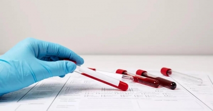 EN UZUN YAŞAYAN KAN GRUBU BELLİ OLDU