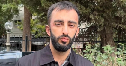 BAŞIBOŞ KÖPEKLER, ÇOCUĞUNA BEZ ALMAYA GİDEN VATANDAŞA SALDIRDI