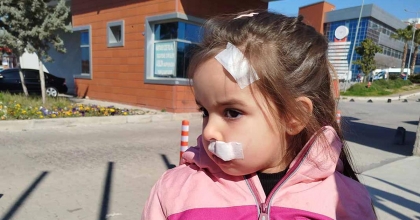 İZMİR'DE AVM'DEKİ SAHİPSİZ KÖPEK 3 YAŞINDAKİ ELİF'E SALDIRDI