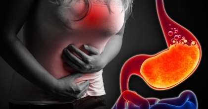 REFLÜDEN CERRAHİ MÜDAHALEYLE KURTULMAK MÜMKÜN