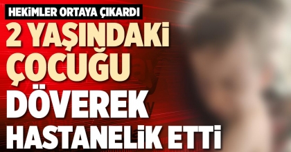 2 YAŞINDAKİ ÇOCUĞU DÖVEREK HASTANELİK ETTİ