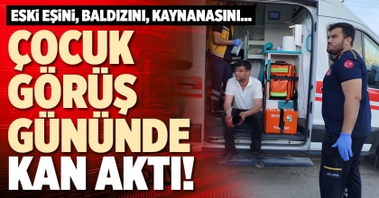 ÇOCUK GÖRÜŞ GÜNÜNDE KAN AKTI!