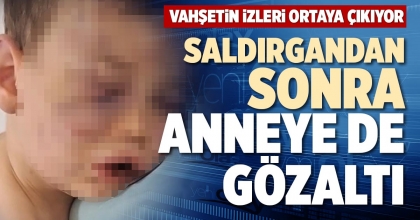 SALDIRGANDAN SONRA ANNEYE DE GÖZALTI