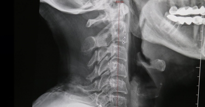 DİJİTAL BAĞIMLILIK VÜCUDA YARAMIYOR