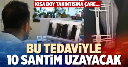 BU TEDAVİYLE 10 SANTİM UZAYACAK