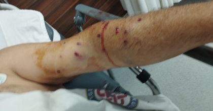 İZMİR’DE TIR SAHİBİ 180 LİRALIK KANTAR ÜCRETİ İÇİN ÇALIŞANI VURDU