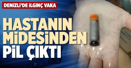 HASTANIN MİDESİNDEN PİL ÇIKTI