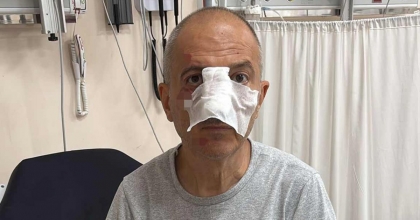 ÖNCE İCRA YOLUYLA EVİNDEN TAHLİYE EDİLDİ, ARDINDAN DARP EDİLDİ