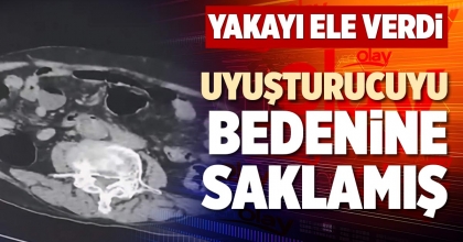 UYUŞTURUCUYU BEDENİNE SAKLAMIŞ