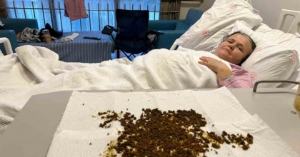 HASTADAN ÇIKAN TAŞLARI SAYAMADILAR