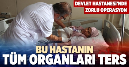 BU HASTANIN TÜM ORGANLARI TERS