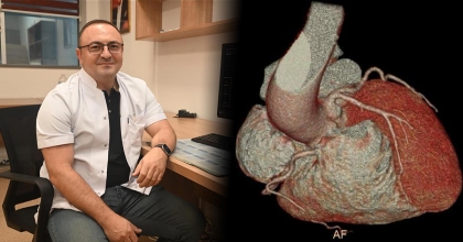 KALP HASTALIKLARINDA ERKEN TANI İÇİN ANAHTAR: KARDİYAK BT VE MR