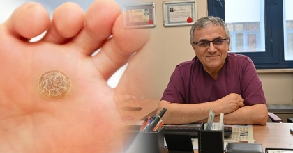 YAZDAN KALAN AYAK TABANI SİĞİLLERİ SONBAHARDA ARTIYOR