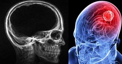 BEYİNDE CÖMERTLİK SİNYALİ KEŞFEDİLDİ