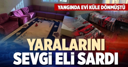 YARALARINI SEVGİ ELİ SARDI