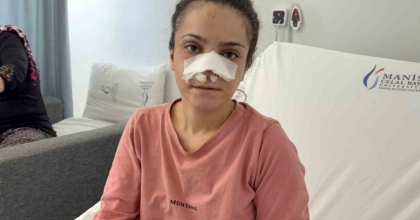 EŞİNİN KOPARDIĞI BURNU BAŞARILI OPERASYONLA YERİNE DİKİLDİ