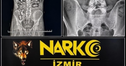 HAVALİMANINDA ŞÜPHELİ YOLCULARIN MİDESİNDEN UYUŞTURUCU ÇIKTI
