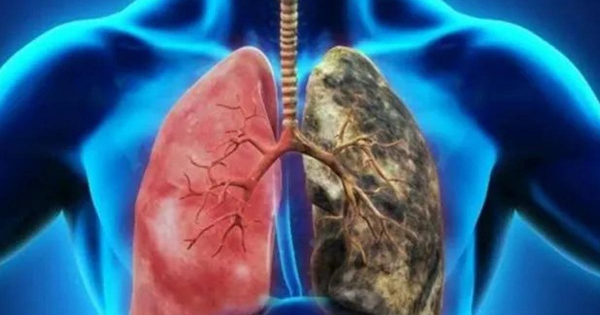 SAĞLIK MÜDÜRÜ ÖZTÜRK KOAH’A DİKKAT ÇEKTİ